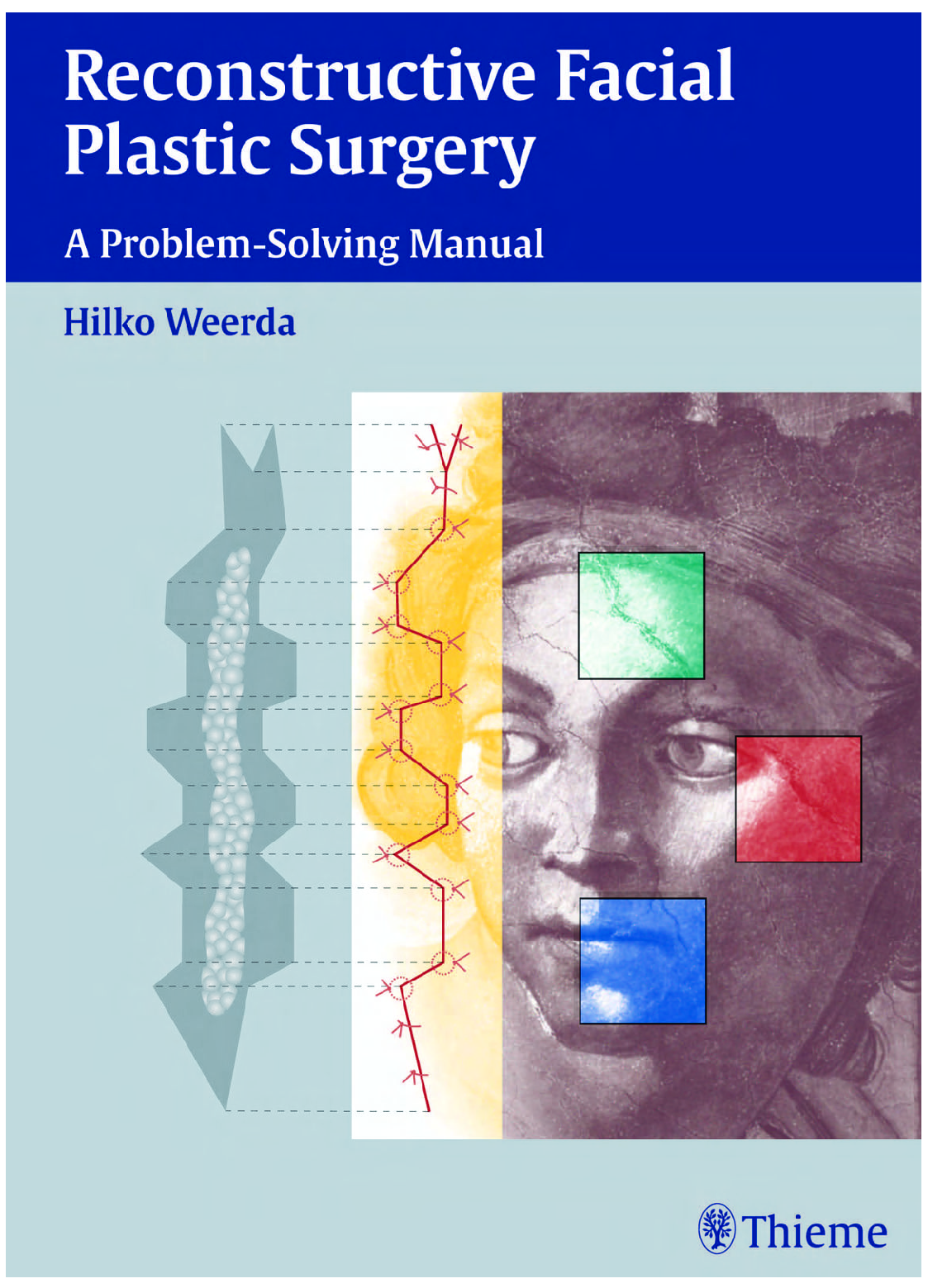 Recommended document preview for Reconstructive Facial Plastic Surgery A Problem-Solving Manual Expanded Edition 1st Edition By Hilko Weerda PDF ebook