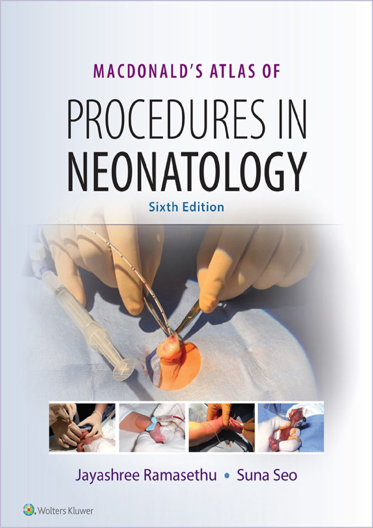 Preview of MacDonald's Atlas of Procedures in Neonatology 6th Edition By Jayashree Ramasethu, Suna Se