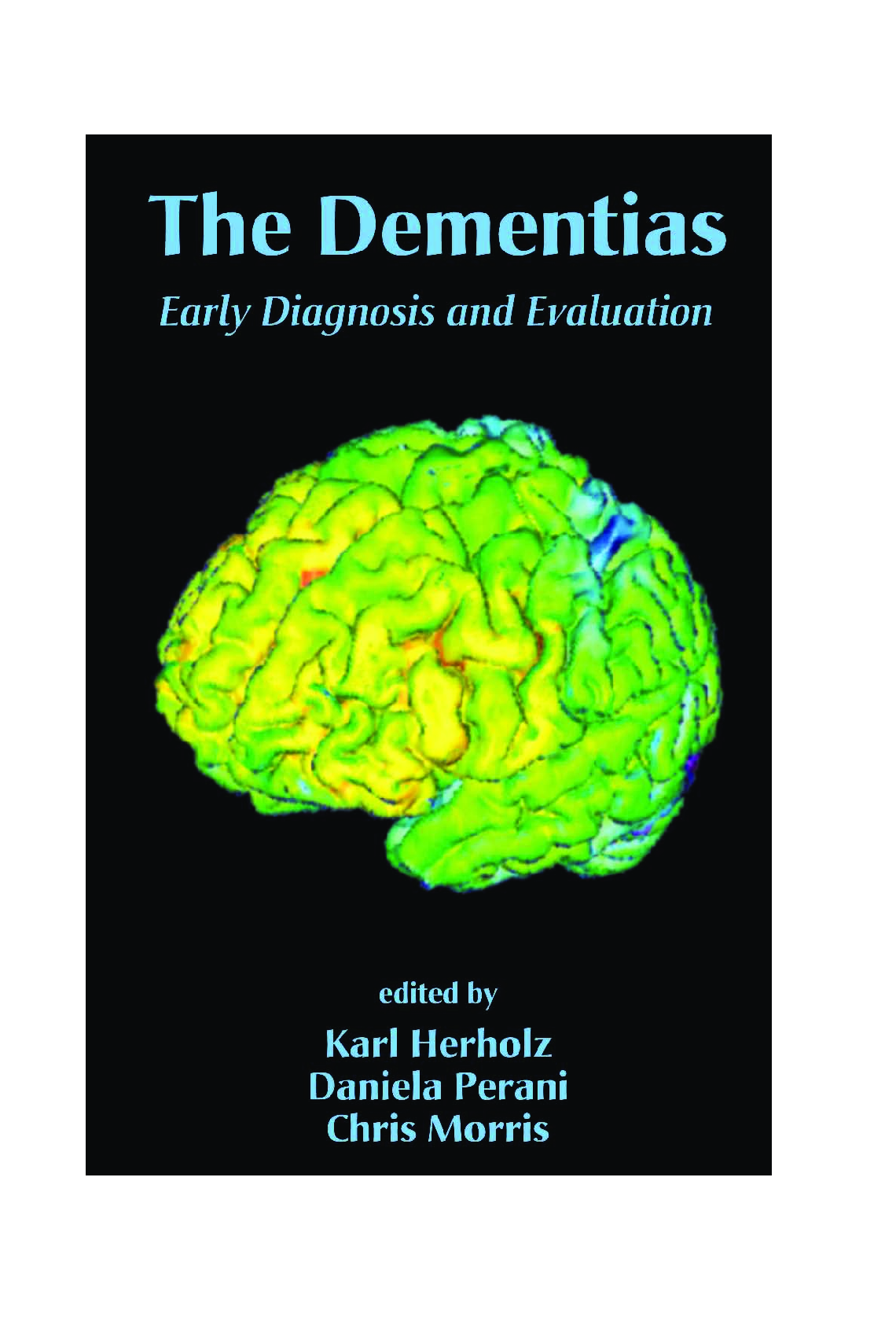 Recommended document preview for The Dementias Early Diagnosis and Evaluation 1st Edition By Karl Herholz, Daniela Perani, Chris Morris PDF ebook