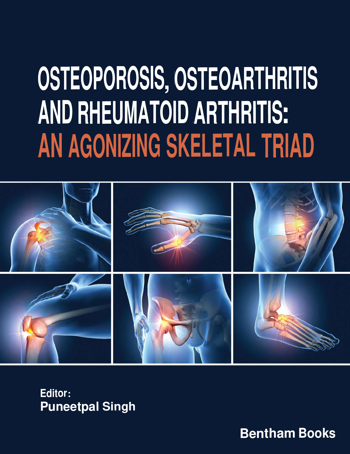 Recommended document preview for Osteoporosis Osteoarthritis and Rheumatoid Arthritis An Agonizing Skeletal Triad 1st Edition By Puneetpal Singh PDF ebook