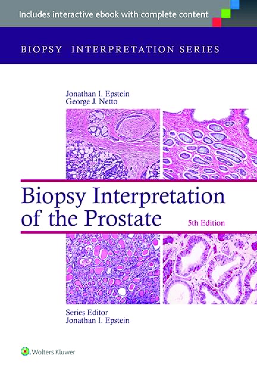 Recommended document preview for eBook PDF Biopsy Interpretation of the Prostate 5th Edition By Jonathan Epstein, George Netto