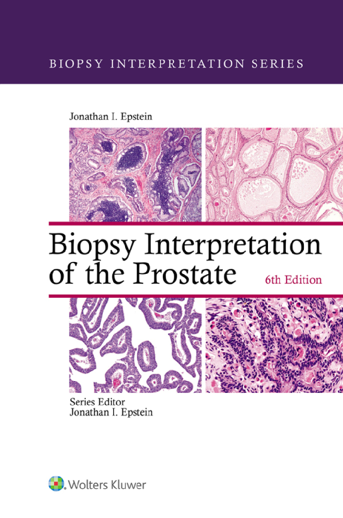 Recommended document preview for eBook PDF Biopsy Interpretation of the Prostate 6th Edition By Jonathan Epstein