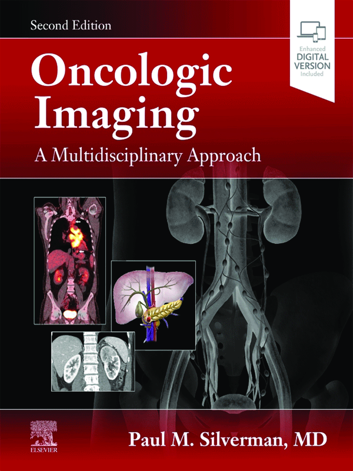 Recommended document preview for eBook PDF for Oncologic Imaging A Multidisciplinary Approach 2nd Edition By Paul M. Silverman MD