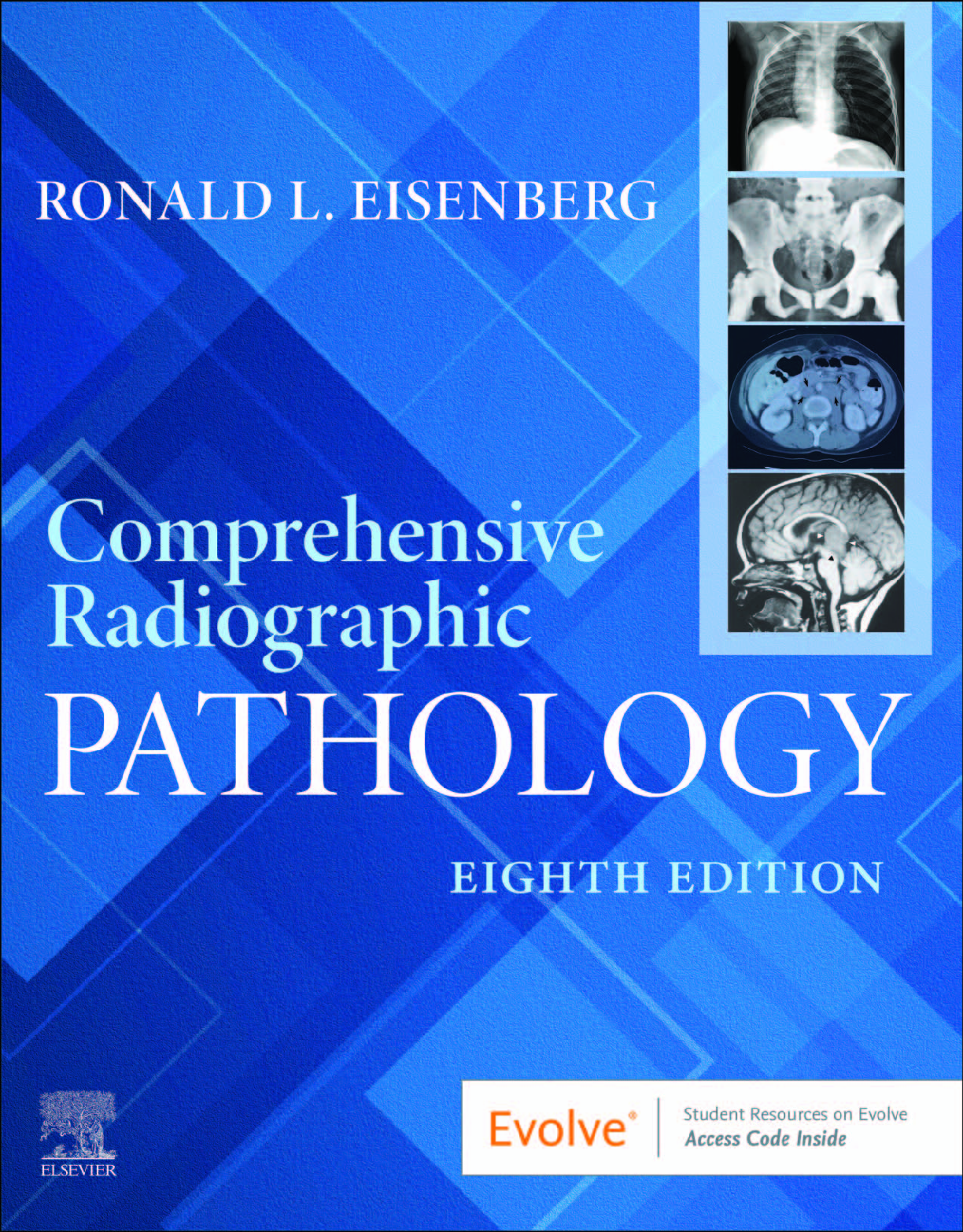 Recommended document preview for eBook PDF Comprehensive Radiographic Pathology 8th Edition By Ronald Eisenberg