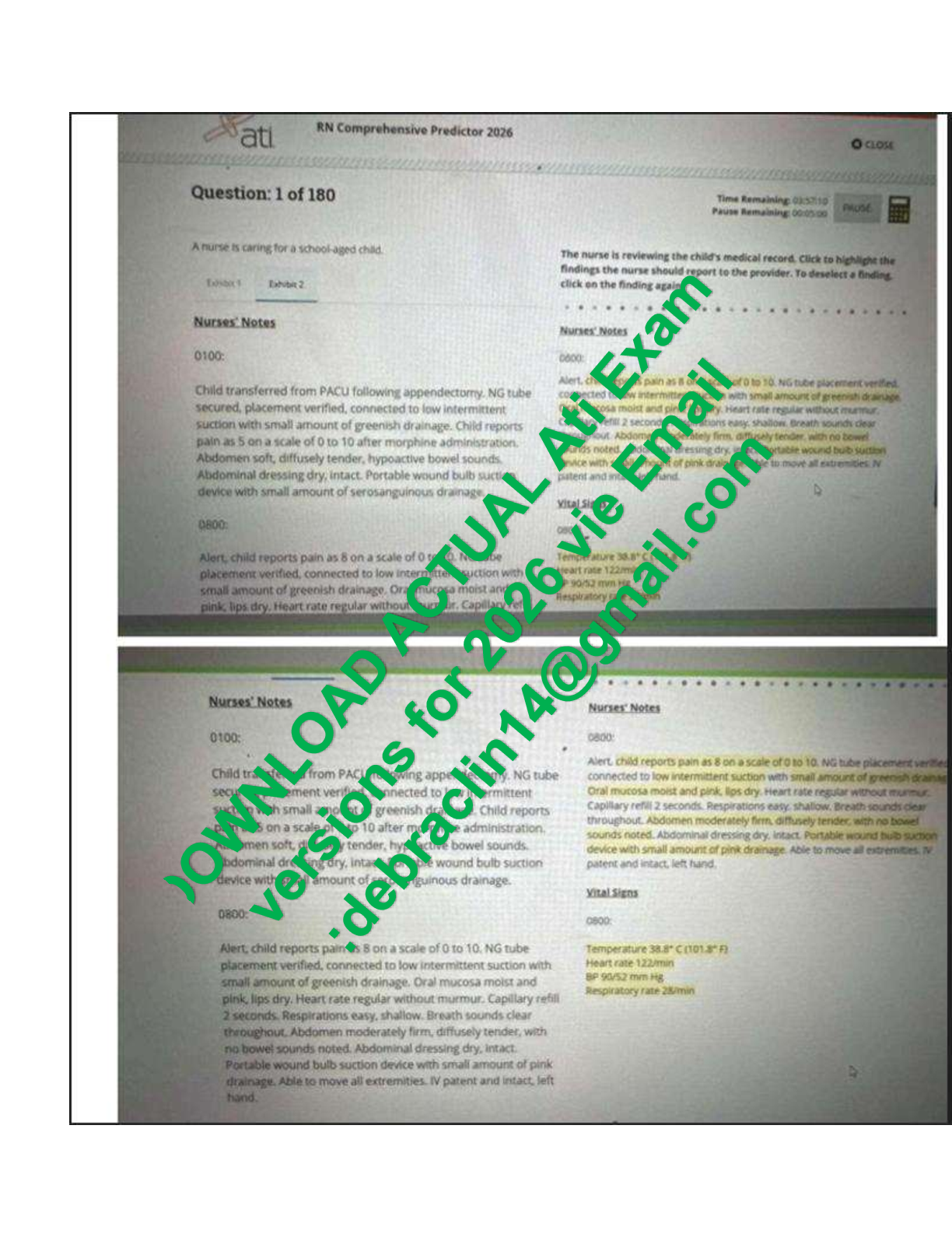 Preview of Actual ATI RN Comprehensive Predictor 2026 Exit Exam with NGN 100% Verified Answers 180 Qu