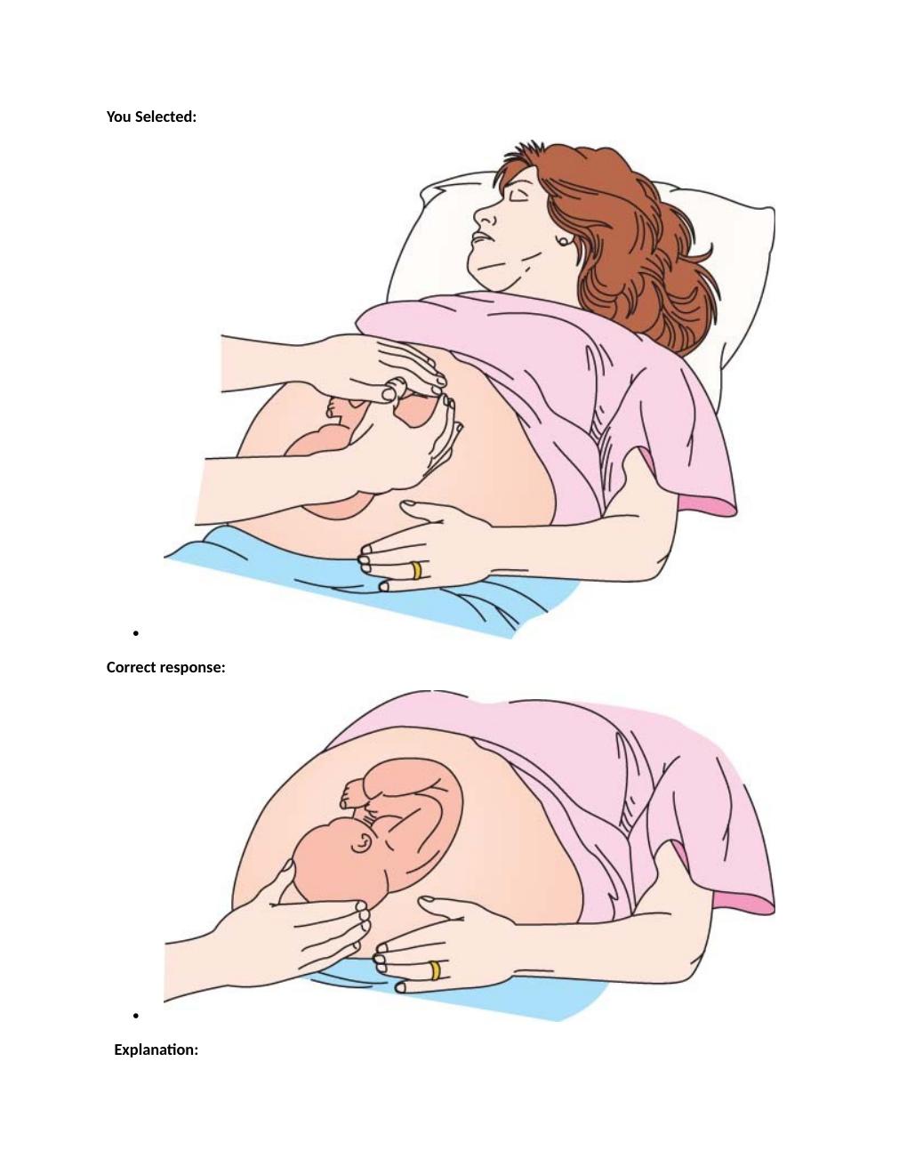 Preview page 4 of Passpoint Intrapartum | A nurse is caring for a client with mild active bleeding from placenta previa. Which assessment