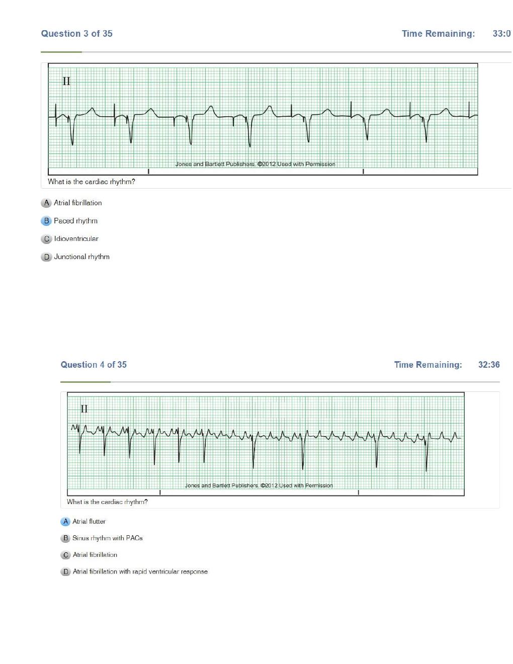 Preview page 2 of Relias Dysrhythmia Basic Test Answers  Dysrhythmia – Basic A ( A+ GRADED 100% VERIFIED)