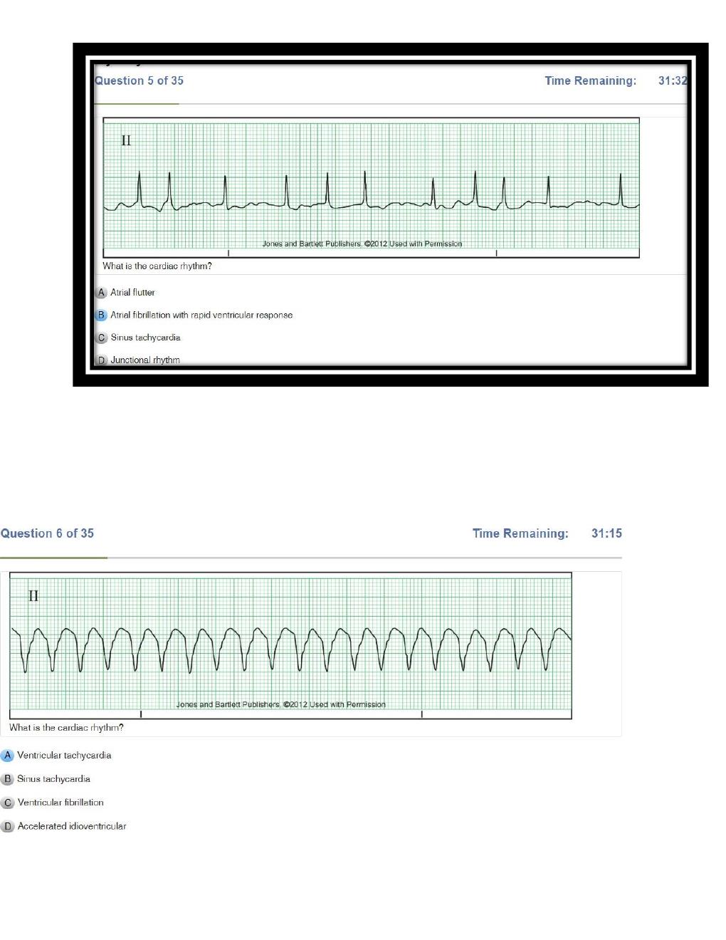 Preview page 3 of Relias Dysrhythmia Basic Test Answers  Dysrhythmia – Basic A ( A+ GRADED 100% VERIFIED)