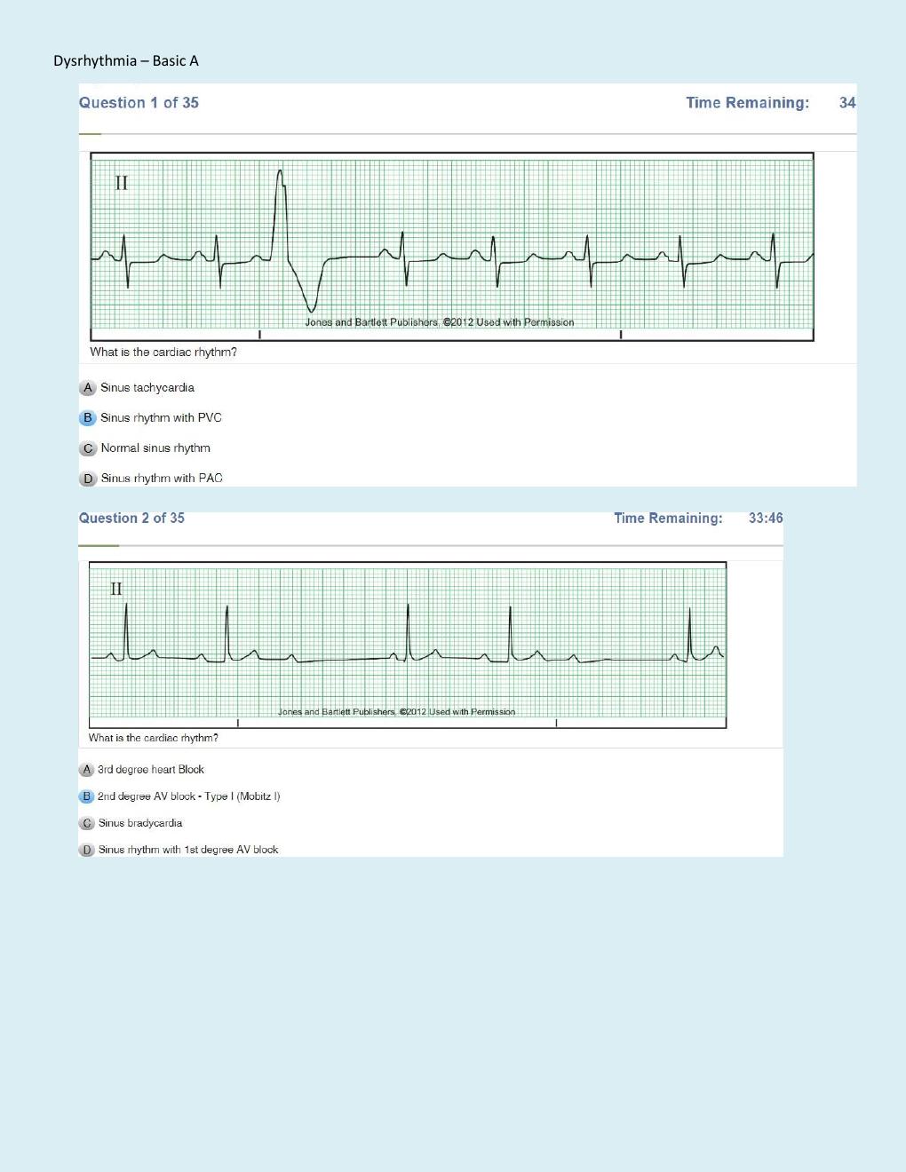 Preview page 2 of Relias Dysrhythmia Basic Test Questions and Answers   Dysrhythmia – Basic A (A+ GRADED 100% VERIFIED)