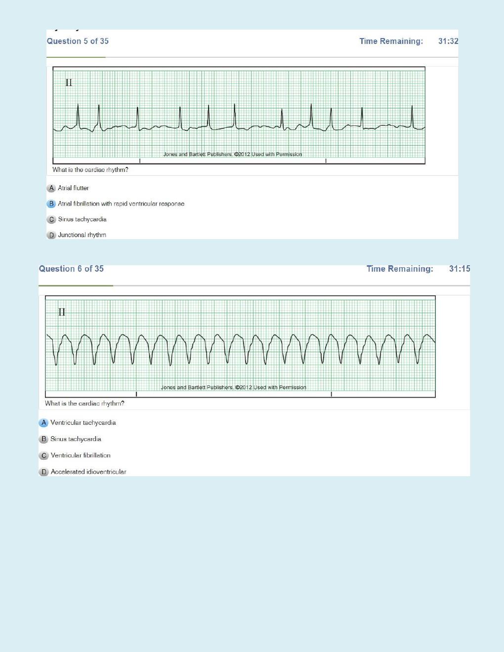 Preview page 4 of Relias Dysrhythmia Basic Test Questions and Answers   Dysrhythmia – Basic A (A+ GRADED 100% VERIFIED)