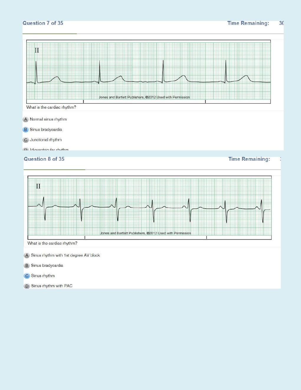Preview page 5 of Relias Dysrhythmia Basic Test Questions and Answers   Dysrhythmia – Basic A (A+ GRADED 100% VERIFIED)