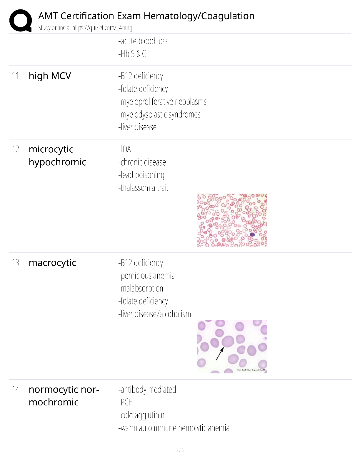 Preview page 2 of AMT Certification Exam Hematology Coagulation / score 100% / 2025 update / medical technologist study guide