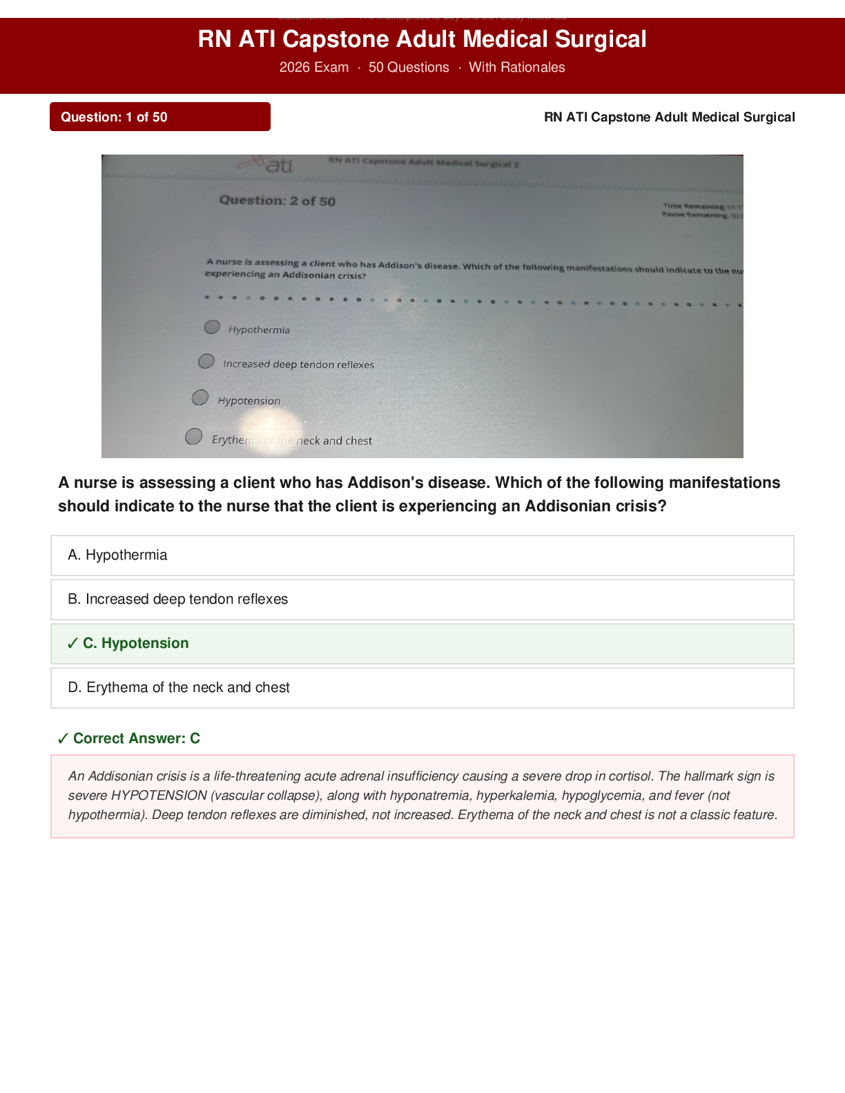 Preview of RN ATI Capstone Adult Medical Surgical 2026 Exam 50 Questions And Answers