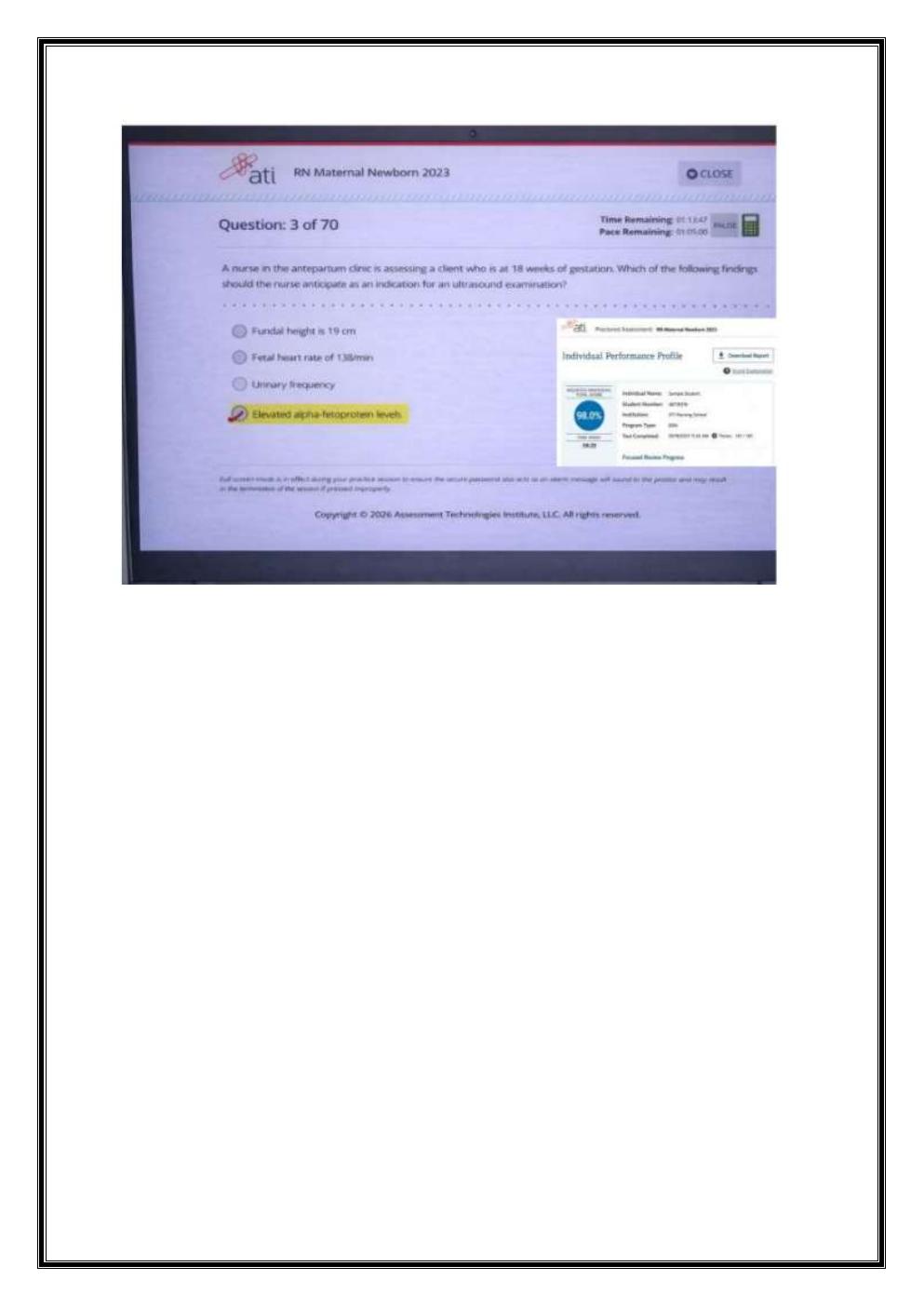 Preview page 4 of ATI RN MATERNAL NEWBORN OB 2023-2026