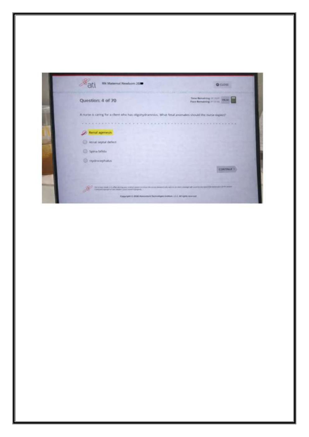 Preview page 5 of ATI RN MATERNAL NEWBORN OB 2023-2026