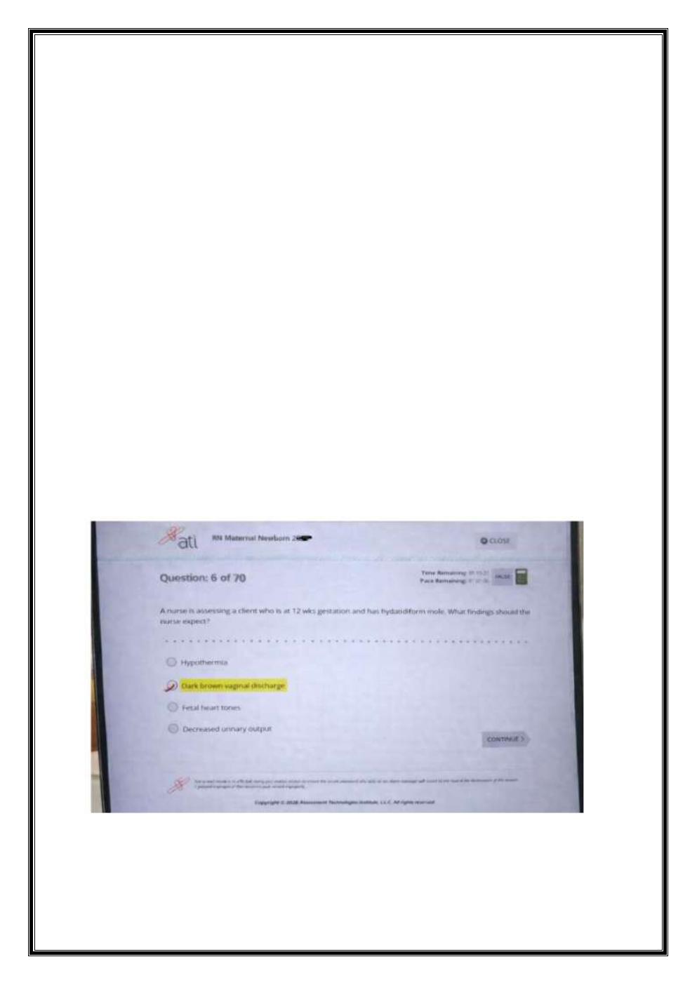 Preview page 7 of ATI RN MATERNAL NEWBORN OB 2023-2026