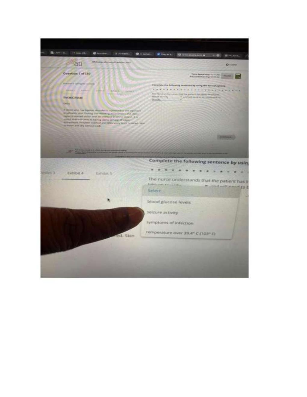 Preview page 3 of ATI RN Comprehensive Predictor Exit  Proctored Exam With screenshots,  questions, and correct verified answers.  Guarant