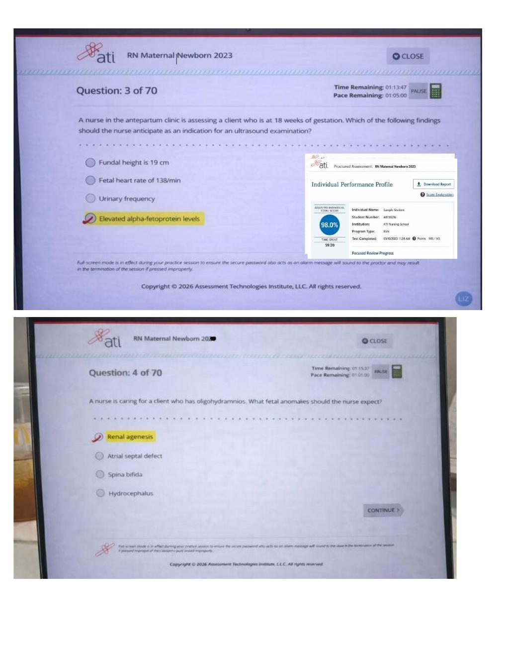 Preview page 2 of ATI RN CMS Maternal Newborn 2026 | Nursing Practice Questions, OB Review and Study Guide