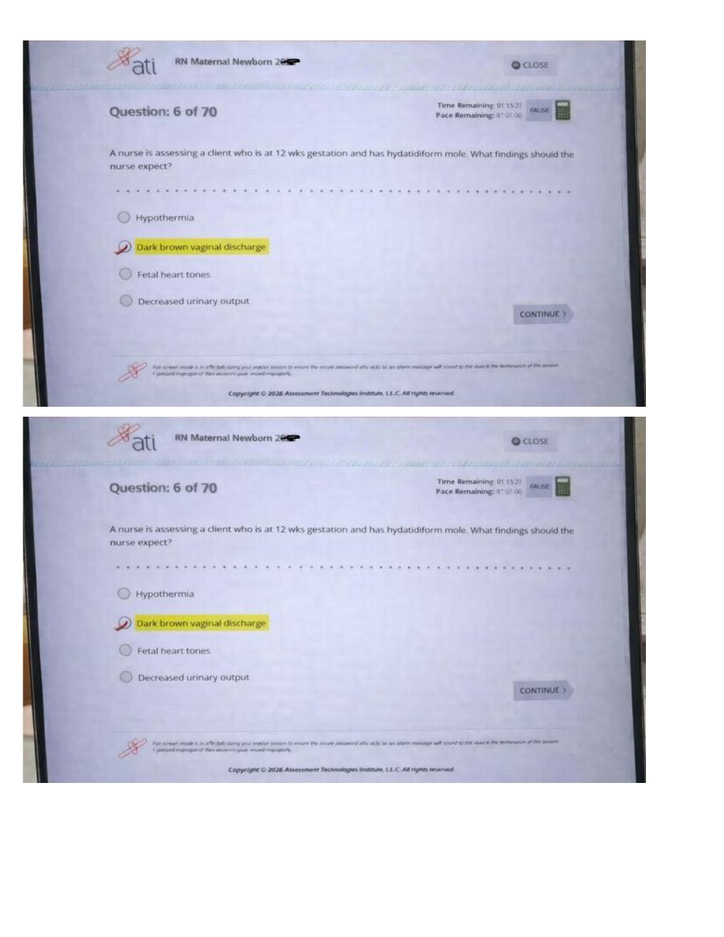 Preview page 3 of ATI RN CMS Maternal Newborn 2026 | Nursing Practice Questions, OB Review and Study Guide