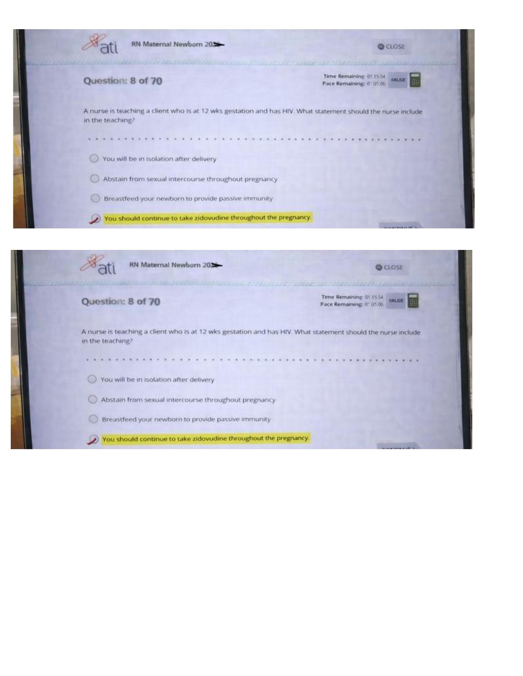 Preview page 4 of ATI RN CMS Maternal Newborn 2026 | Nursing Practice Questions, OB Review and Study Guide