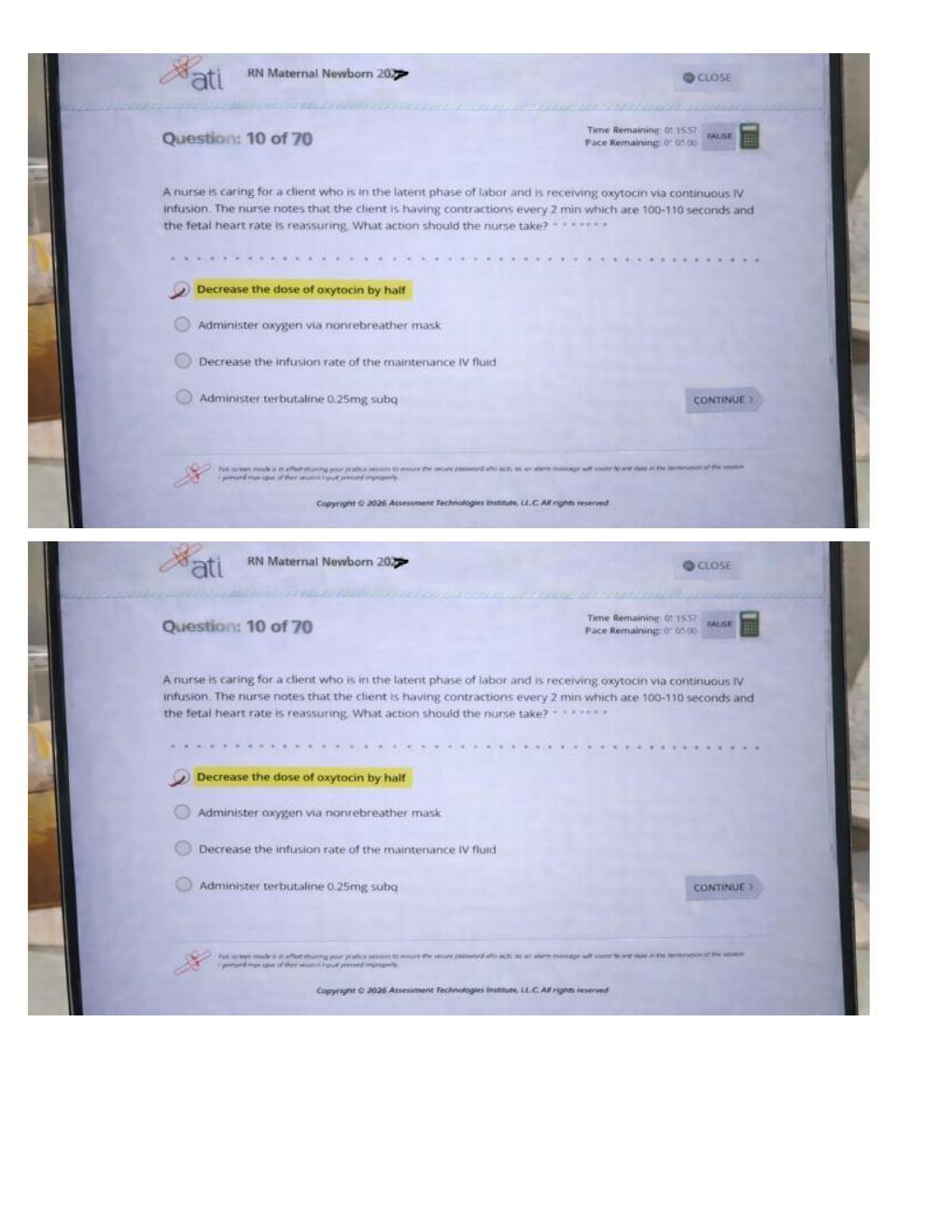 Preview page 5 of ATI RN CMS Maternal Newborn 2026 | Nursing Practice Questions, OB Review and Study Guide