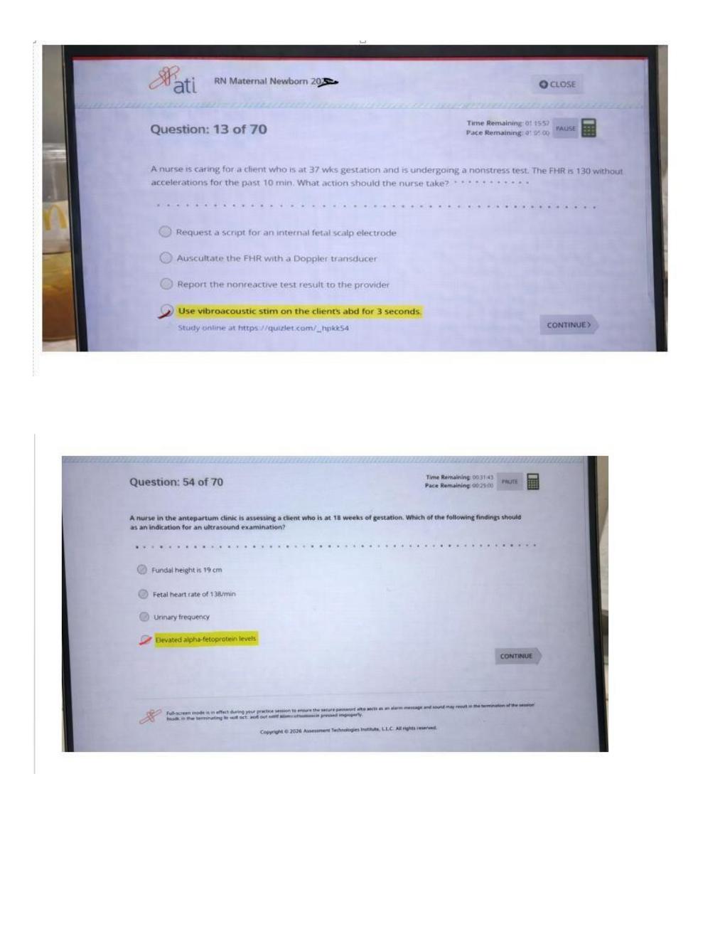 Preview page 7 of ATI RN CMS Maternal Newborn 2026 | Nursing Practice Questions, OB Review and Study Guide