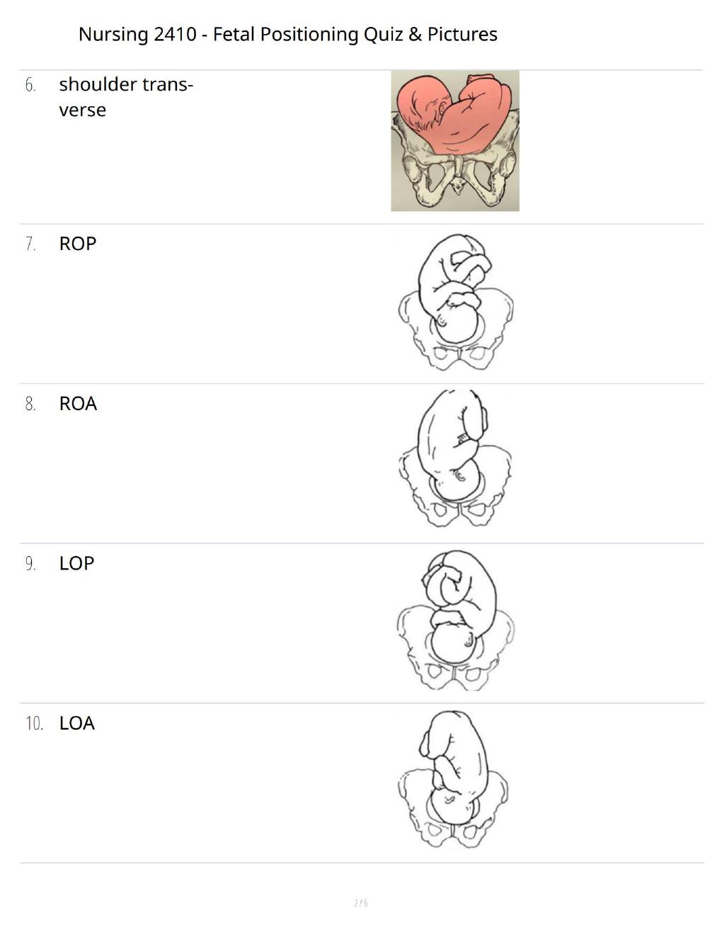 Preview page 2 of Nursing 2410 Fetal Positioning Quiz – Practice Questions with Illustrations & Answer Review