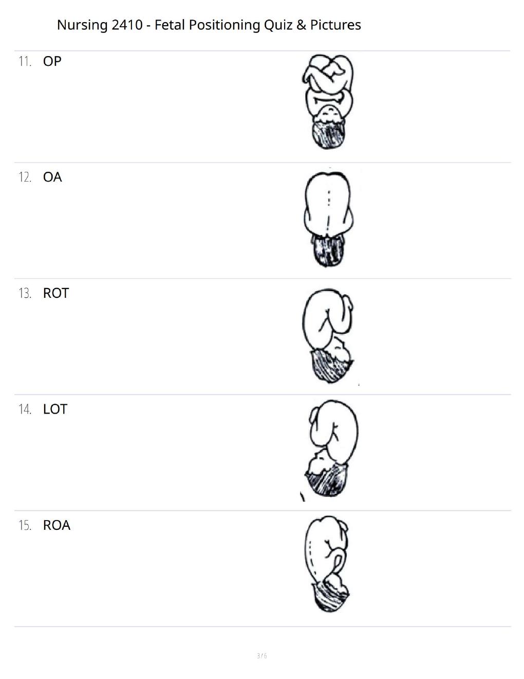Preview page 3 of Nursing 2410 Fetal Positioning Quiz – Practice Questions with Illustrations & Answer Review