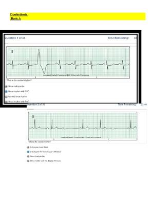 Preview of Relias Dysrhythmia Basic Test Answers  Dysrhythmia – Basic A ( A+ GRADED 100% VERIFIED)