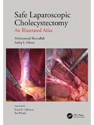 Preview of eBook PDF Safe Laparoscopic Cholecystectomy An Illustrated Atlas 1st Edition By Mohammad I