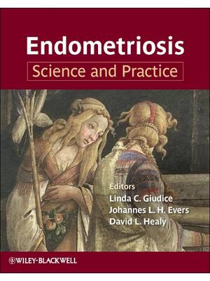 Preview of eBook PDF Endometriosis Science and Practice 1st Edition By  Linda  Giudice, Johannes  Eve