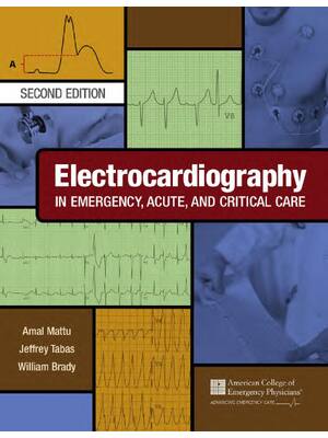 Preview of eBook EPUB PDF Electrocardiography in Emergency Acute and Critical Care 2nd Edition By FAC