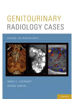 Preview of eBook PDF Genitourinary Radiology Cases Cases in Radiology 1st Edition By Mark E. Lockhart