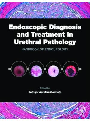 Preview of eBook PDF Endoscopic Diagnosis and Treatment in Urethral Pathology 1st Edition By Petrisor
