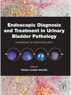 Preview of eBook PDF Endoscopic Diagnosis and Treatment in Urinary Bladder Pathology Handbook of Endo