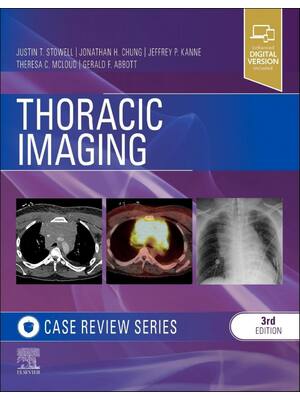 Preview of eBook PDF Thoracic Imaging Case Review 3rd Edition By Justin Stowell, Jonathan Chung, Jeff