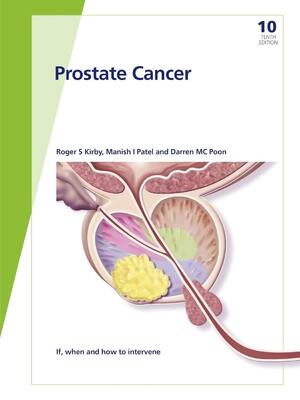 Preview of eBook PDF Fast Facts Prostate Cancer If when and how to intervene 10th Edition By R.S. Kir