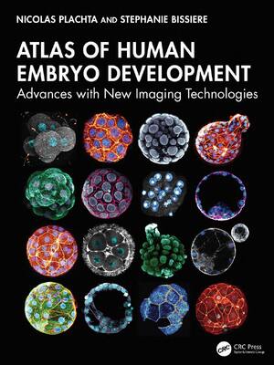 Preview of Atlas of Human Embryo Development Advances with New Imaging Technologies 1st Edition By Ni