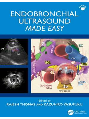 Preview of Endobronchial Ultrasound Made Easy 1st Edition By Rajesh Thomas, Kazuhiro Yasufuku