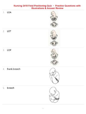 Preview of Nursing 2410 Fetal Positioning Quiz – Practice Questions with Illustrations & Answer Revie