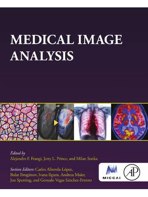 Preview image for Medical Image Analysis By Alejandro Frangi, Jerry Prince, Milan Sonka ISBN: 9780128136584
