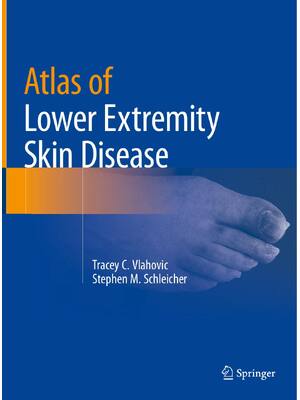 Preview of eBook Atlas of Lower Extremity Skin Disease 1st Edition By Tracey C. Vlahovic , Stephen M.