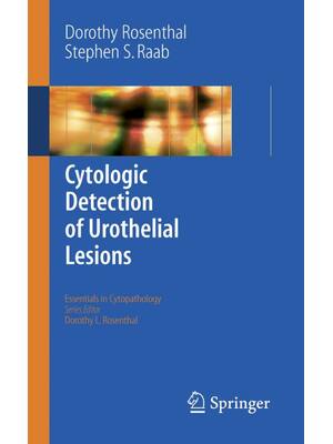 Preview of eBook  Cytologic Detection of Urothelial Lesions  1st Edition By Dorothy Rosenthal , Steph