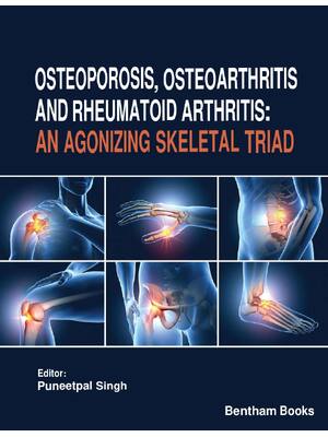 Preview of Osteoporosis Osteoarthritis and Rheumatoid Arthritis An Agonizing Skeletal Triad 1st Editi