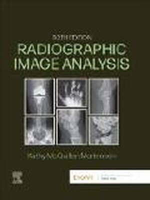 Preview of Radiographic Image Analysis 6th Edition By Kathy McQuillen Martensen