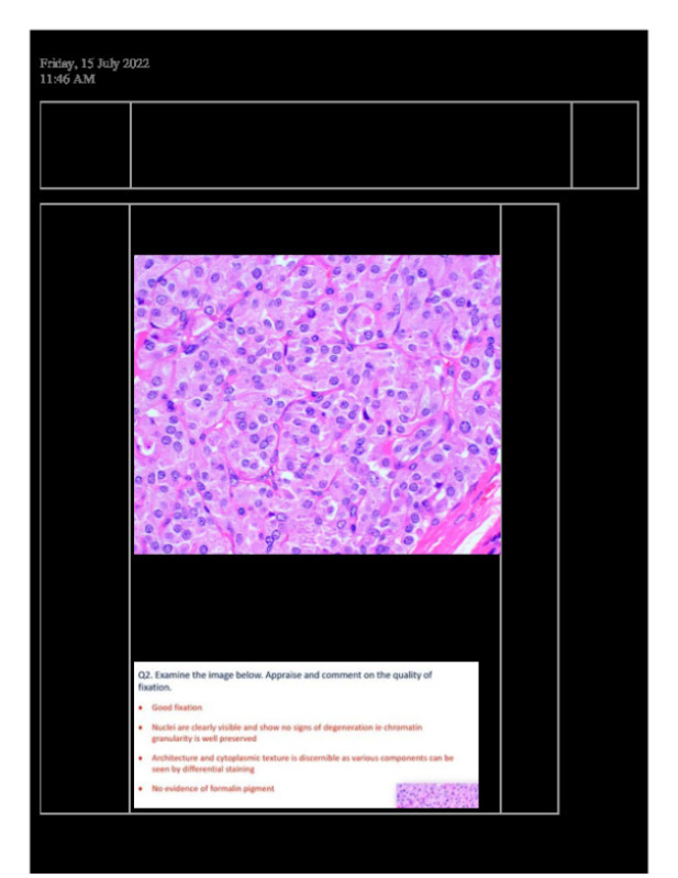 WB_1_Fixation.pdf