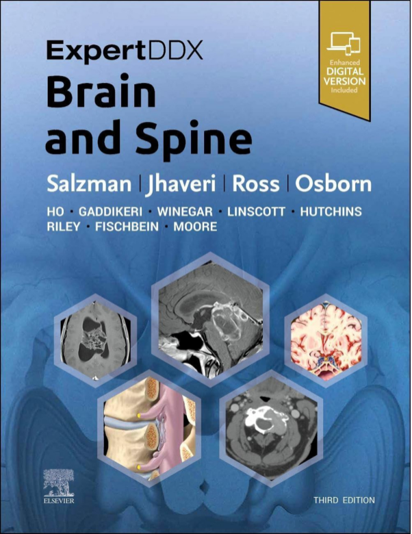 Brain and Spine 3rd Edition by Karen L. Salzman MD, Miral D. Jhaveri MD MBA, Jeffrey S. Ross MD