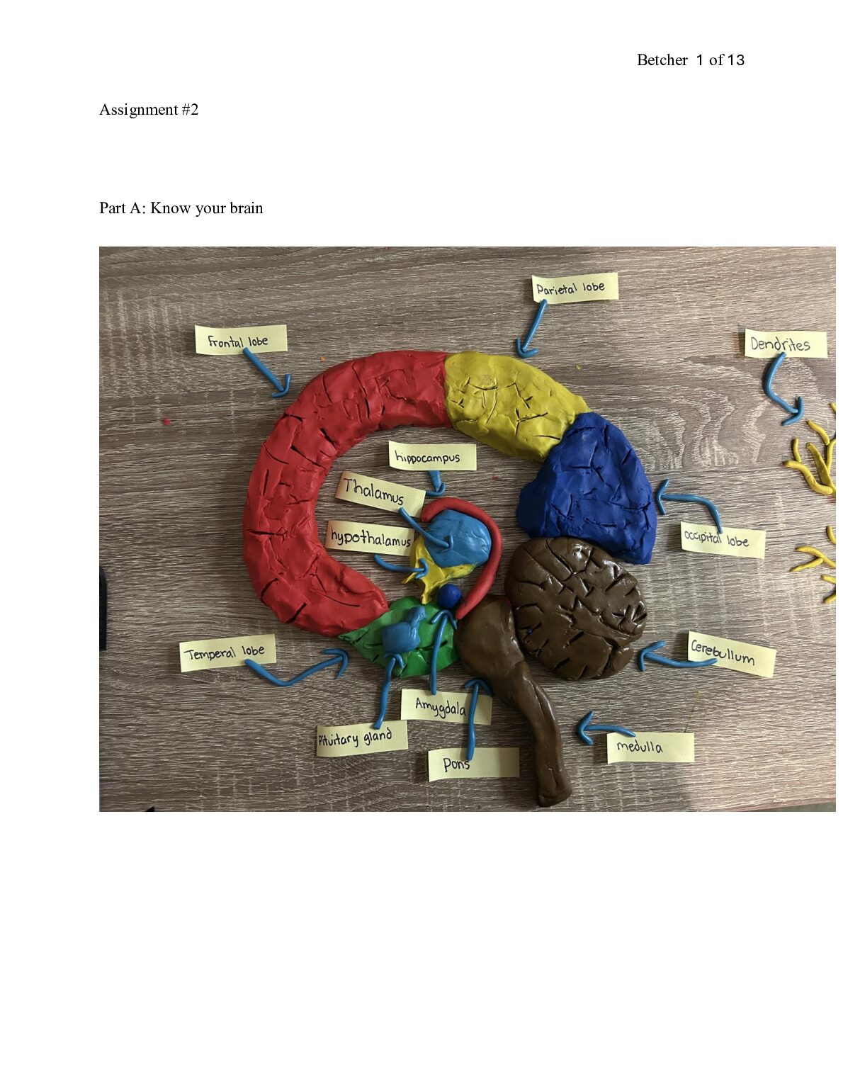 PSYC 1111  Assignment #2 Part A: Know your brain preview image