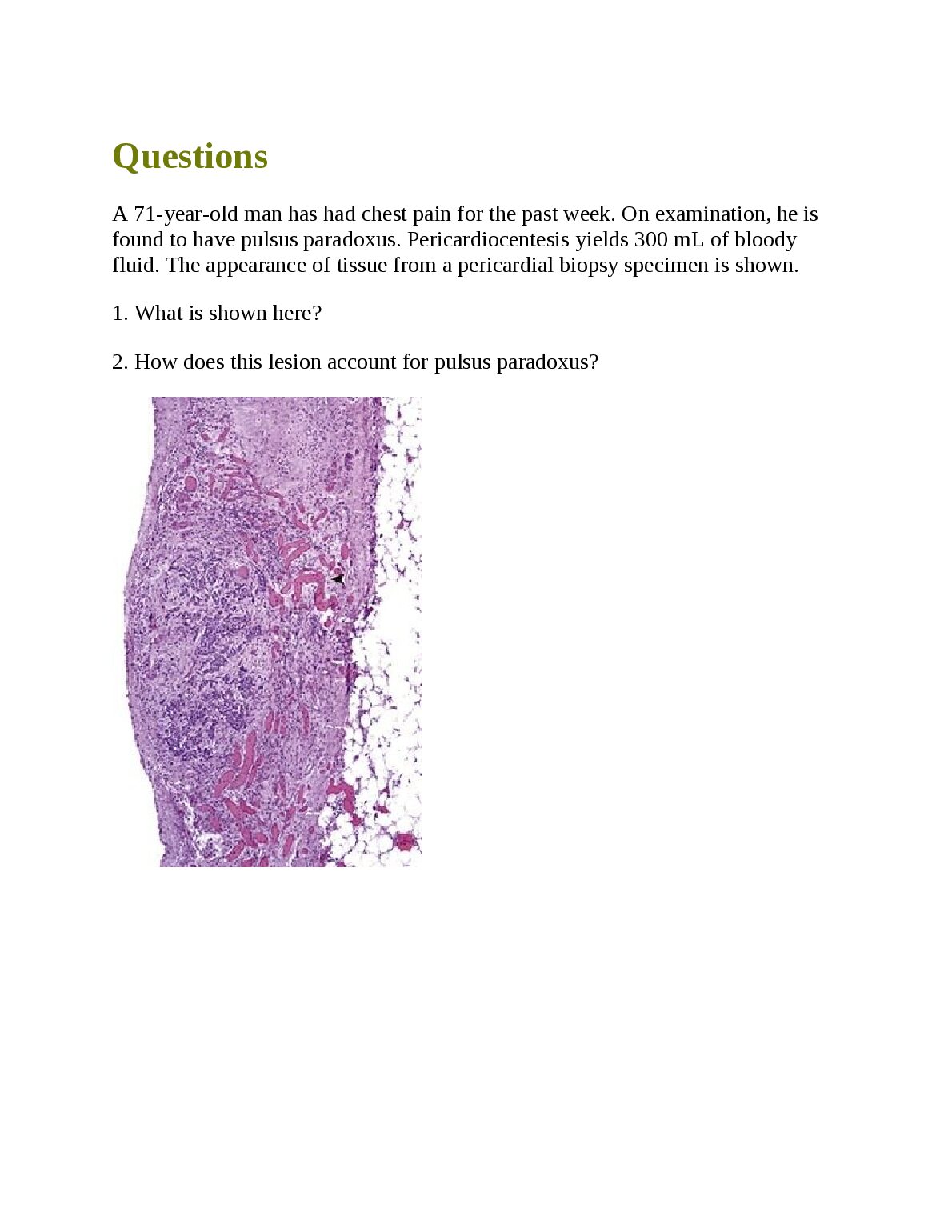 BIO 55-205 Robbins and Cotran Pathology unit 3 test bank questions preview image
